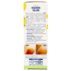 PREP CREMA RIGENERA TALLONI SCREPOLATI 75 ML